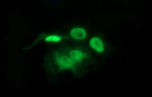 SIVA1 Antibody in Immunocytochemistry (ICC/IF)