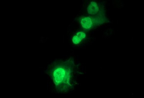 SIVA1 Antibody in Immunocytochemistry (ICC/IF)