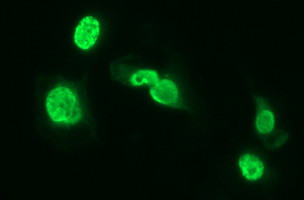 SIVA1 Antibody in Immunocytochemistry (ICC/IF)