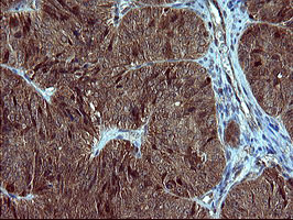 SIVA1 Antibody in Immunohistochemistry (Paraffin) (IHC (P))