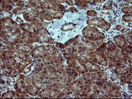 SIVA1 Antibody in Immunohistochemistry (Paraffin) (IHC (P))