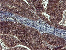 SIVA1 Antibody in Immunohistochemistry (Paraffin) (IHC (P))