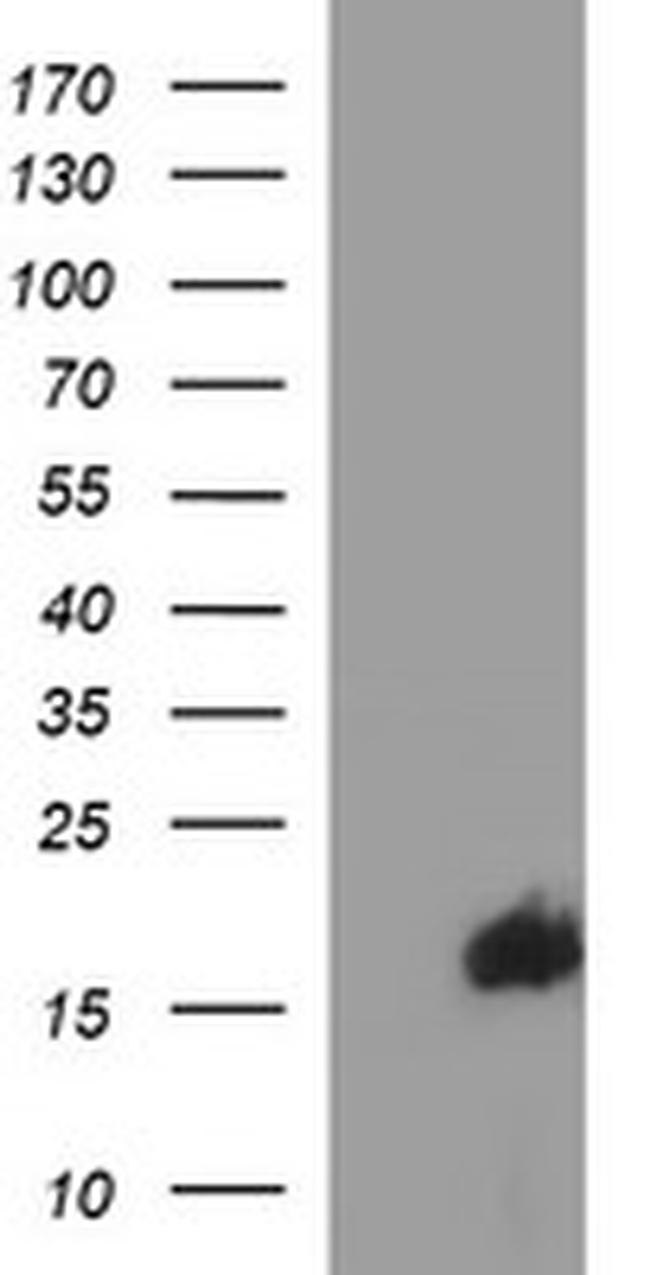 SIVA1 Antibody in Western Blot (WB)