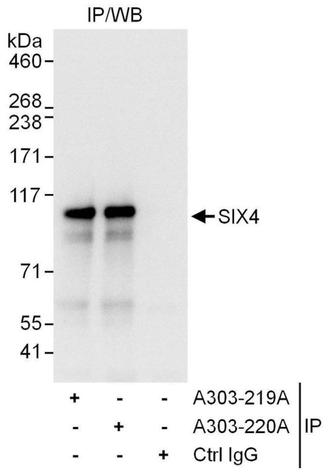 SIX4 Antibody in Immunoprecipitation (IP)