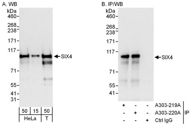 SIX4 Antibody in Western Blot (WB)
