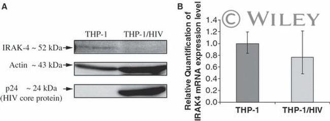 IRAK4 Antibody in Western Blot (WB)