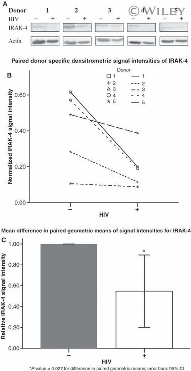 IRAK4 Antibody in Western Blot (WB)