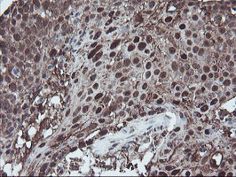 SKIL Antibody in Immunohistochemistry (Paraffin) (IHC (P))