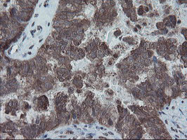 SKIL Antibody in Immunohistochemistry (Paraffin) (IHC (P))