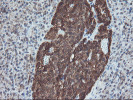 SKIL Antibody in Immunohistochemistry (Paraffin) (IHC (P))