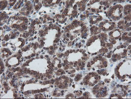 SKIL Antibody in Immunohistochemistry (Paraffin) (IHC (P))