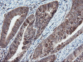 SKIL Antibody in Immunohistochemistry (Paraffin) (IHC (P))