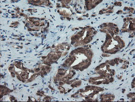 SKIL Antibody in Immunohistochemistry (Paraffin) (IHC (P))