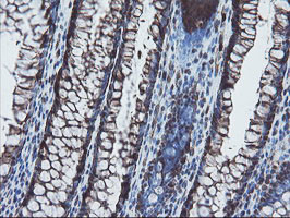 SKIL Antibody in Immunohistochemistry (Paraffin) (IHC (P))