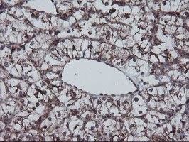 SKIL Antibody in Immunohistochemistry (Paraffin) (IHC (P))