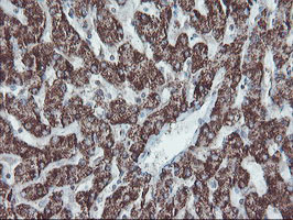 SKIL Antibody in Immunohistochemistry (Paraffin) (IHC (P))