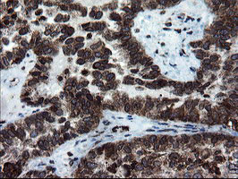 SKIL Antibody in Immunohistochemistry (Paraffin) (IHC (P))