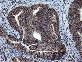 SKIL Antibody in Immunohistochemistry (Paraffin) (IHC (P))