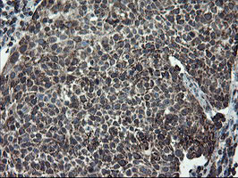 SKIL Antibody in Immunohistochemistry (Paraffin) (IHC (P))