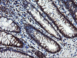 SKIL Antibody in Immunohistochemistry (Paraffin) (IHC (P))