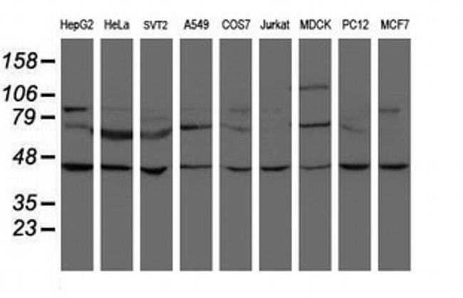 SKIL Antibody in Western Blot (WB)