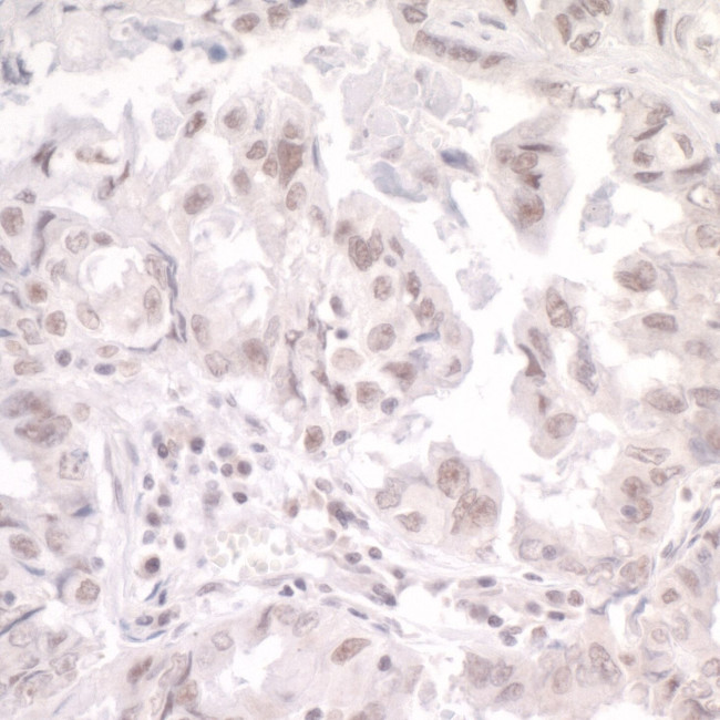 SKIV2L2 Antibody in Immunohistochemistry (IHC)