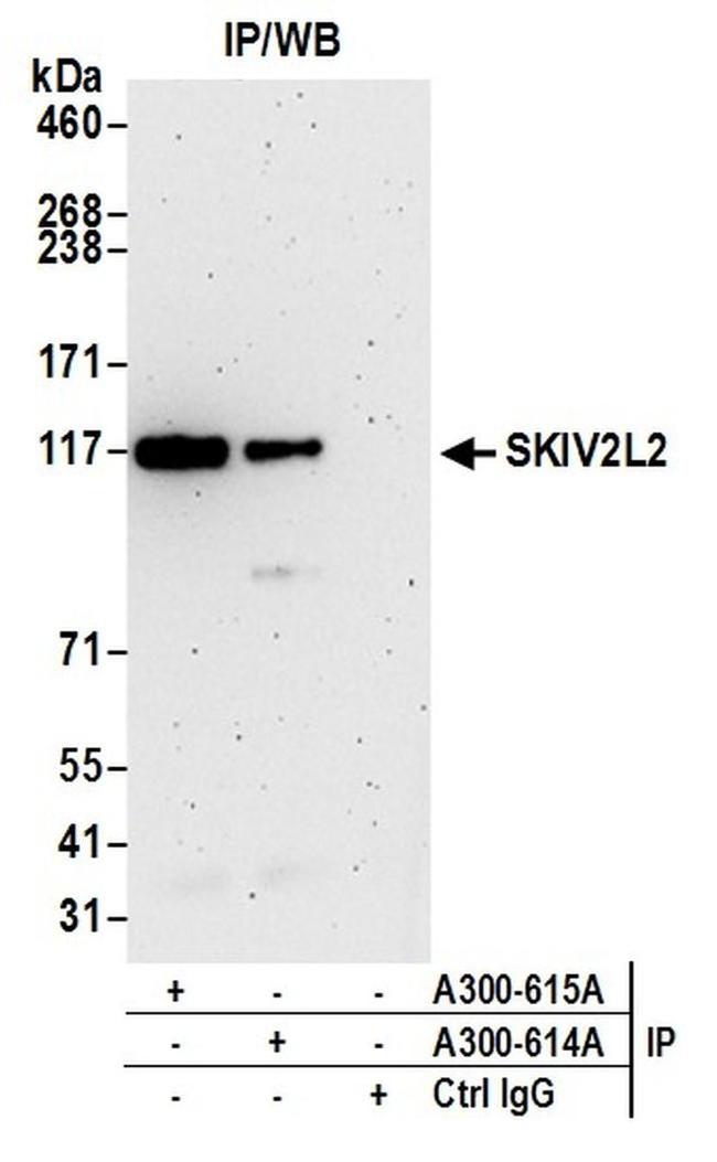 SKIV2L2 Antibody in Western Blot (WB)