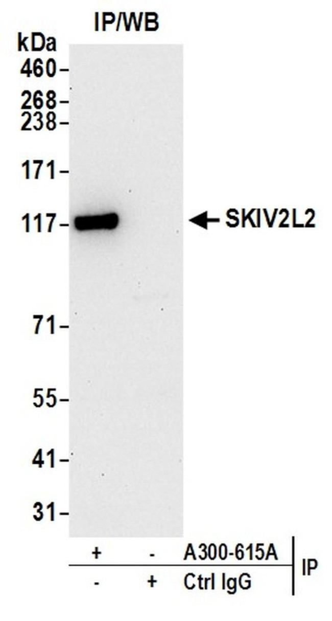 SKIV2L2 Antibody in Immunoprecipitation (IP)