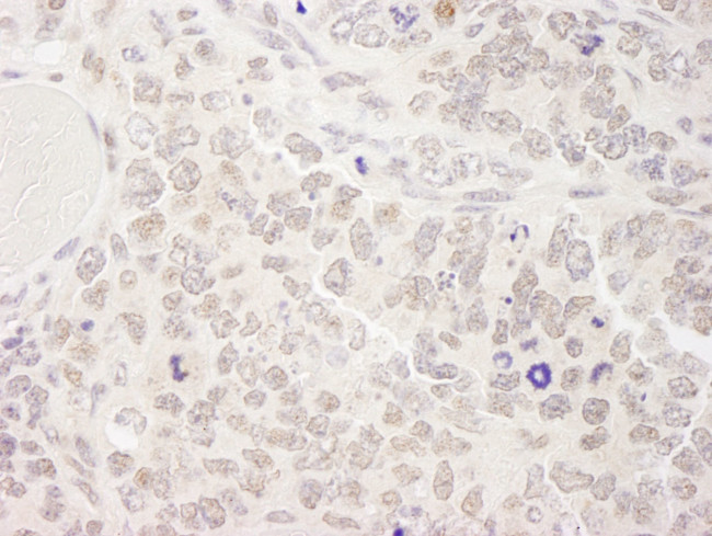 SKIV2L2 Antibody in Immunohistochemistry (IHC)