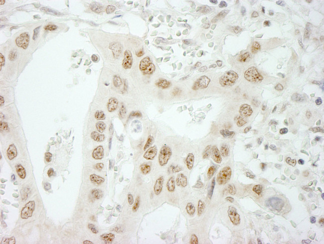 SKIV2L2 Antibody in Immunohistochemistry (IHC)