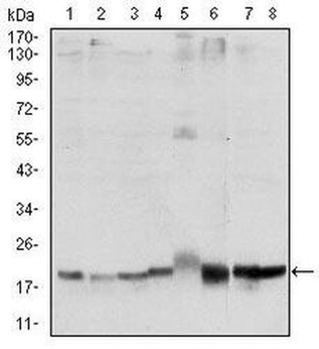 SKP1 Antibody in Western Blot (WB)