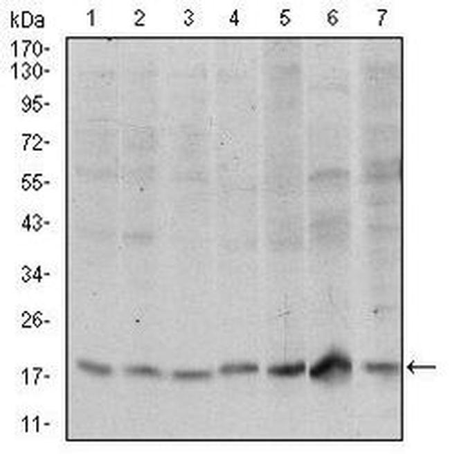 SKP1 Antibody in Western Blot (WB)