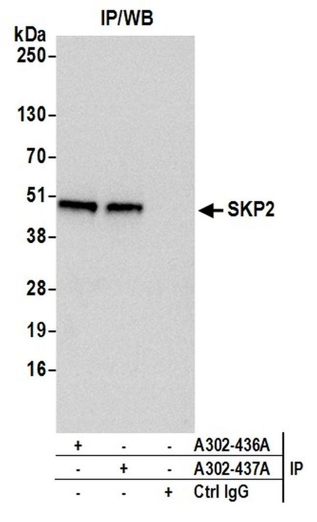 SKP2 Antibody in Western Blot (WB)