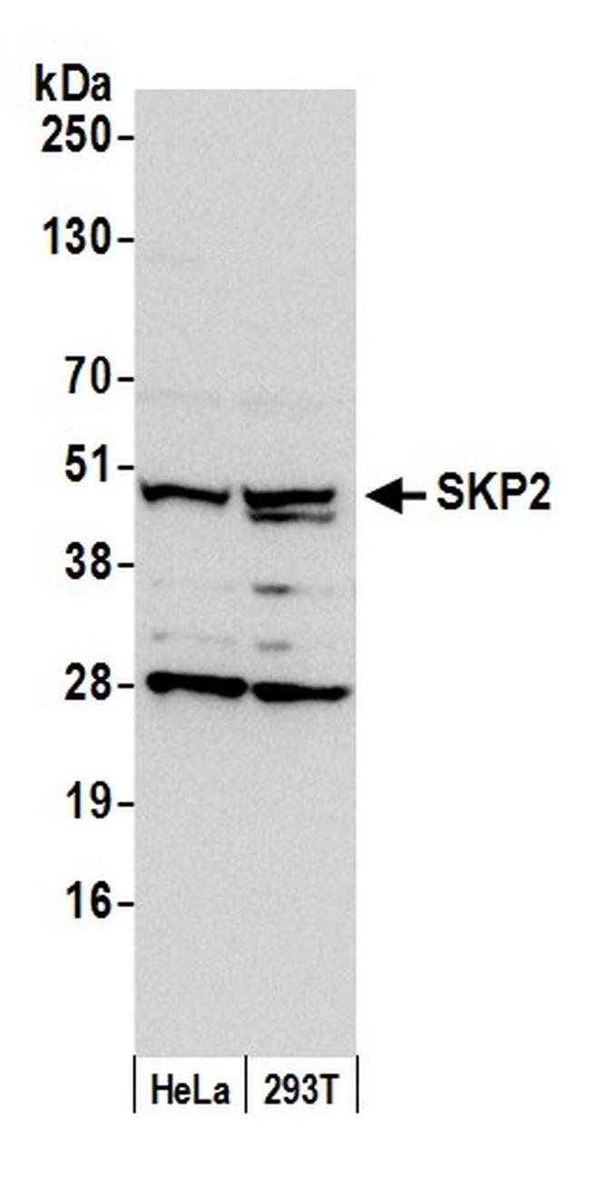 SKP2 Antibody in Western Blot (WB)