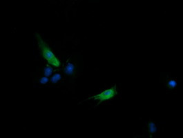 SLA2 Antibody in Immunocytochemistry (ICC/IF)