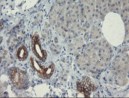 SLA2 Antibody in Immunohistochemistry (Paraffin) (IHC (P))