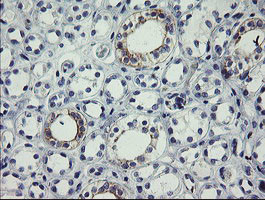 SLA2 Antibody in Immunohistochemistry (Paraffin) (IHC (P))