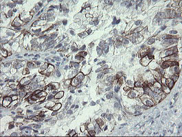 SLA2 Antibody in Immunohistochemistry (Paraffin) (IHC (P))