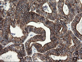 SLA2 Antibody in Immunohistochemistry (Paraffin) (IHC (P))