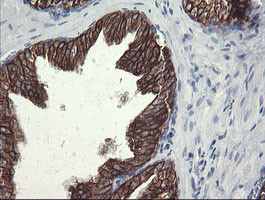 SLA2 Antibody in Immunohistochemistry (Paraffin) (IHC (P))