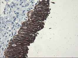 SLA2 Antibody in Immunohistochemistry (Paraffin) (IHC (P))