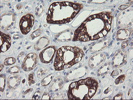 SLA2 Antibody in Immunohistochemistry (Paraffin) (IHC (P))