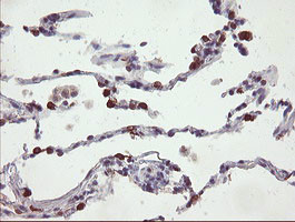 SLA2 Antibody in Immunohistochemistry (Paraffin) (IHC (P))