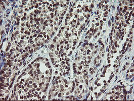 SLA2 Antibody in Immunohistochemistry (Paraffin) (IHC (P))