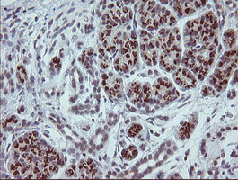 SLA2 Antibody in Immunohistochemistry (Paraffin) (IHC (P))