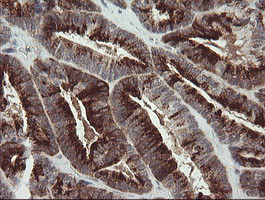 SLA2 Antibody in Immunohistochemistry (Paraffin) (IHC (P))