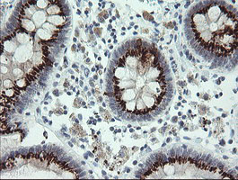 SLA2 Antibody in Immunohistochemistry (Paraffin) (IHC (P))