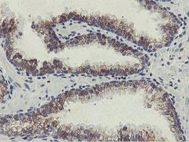 SLA2 Antibody in Immunohistochemistry (Paraffin) (IHC (P))