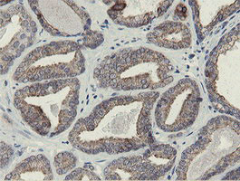 SLA2 Antibody in Immunohistochemistry (Paraffin) (IHC (P))