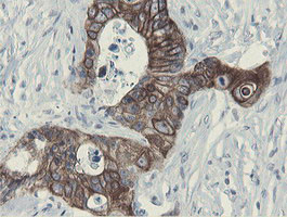 SLA2 Antibody in Immunohistochemistry (Paraffin) (IHC (P))